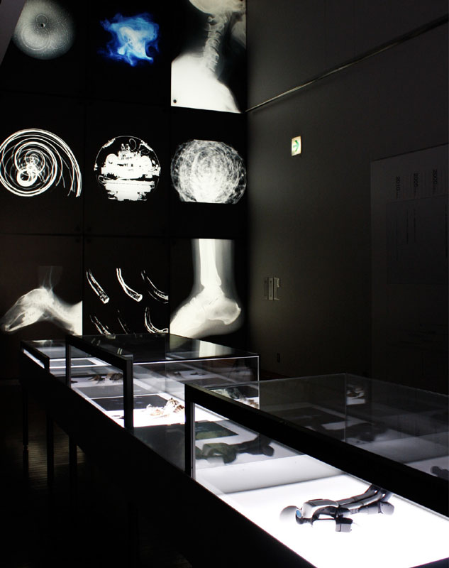 X-RAY Exhibition